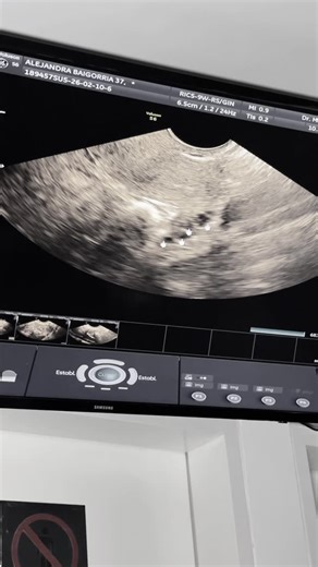 Alejandra Baigorria A. on Instagram: "Ya podemos embarazarnos! @saidpalao_fit Estoy como cañón!! A mis 37 años se ve la importancia de una vida saludable dormir tus horas suplementarte con los mejores productos y lo más importante la fe en dios. Y el acompañamiento del mejor profesional en fertilidad @doctorvelit #alejandrabaigorria #saidpalao #alejandraysaid #viral"