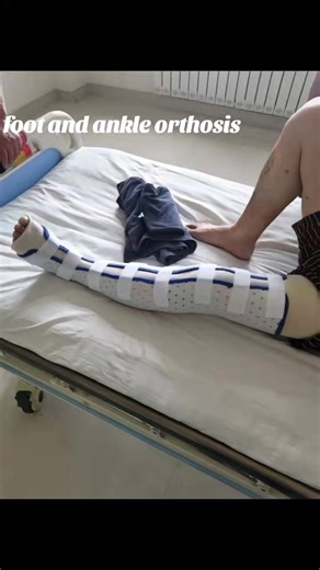 Thermoplastic Foot and Ankle Orthosis for Rehabilitation