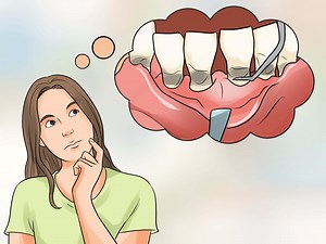 Why Do You Have Itchy Gums? - Brookhaven Dental Group