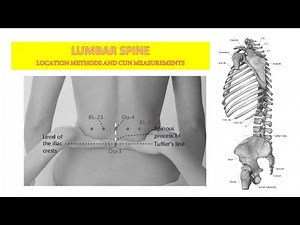 LUMBAR SPINE LOCATION METHODS AND CUN MEASUREMENTS