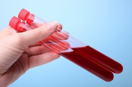 Rhésus : définition, positif, négatif, compatibilité