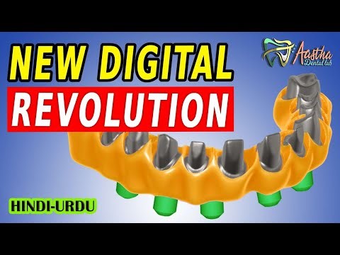 Exocad Implant Screw retained All on 4 Tutorial -HINDI AND URDU