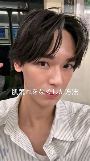 ニキビ跡とホクロがコンプレックスだった僕が垢抜けられた方法を紹介！カウンセリングも丁寧にしていただけるから自分のコンプレックスにあった施術をしていただける🥹問い合わせ先公式LINE：pgc_jp