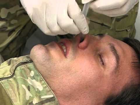Inserting an NPA (Nasopharyngeal Airway)