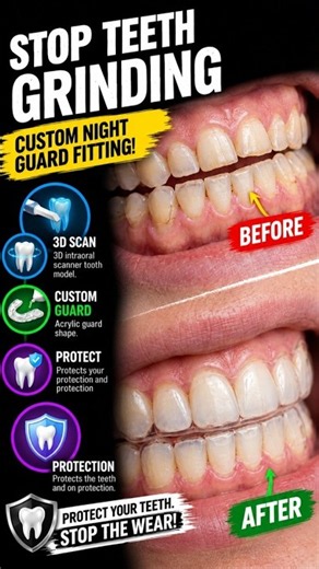 How a custom night guard is made step-by-step 🦷 #DentalTransformation #Medical