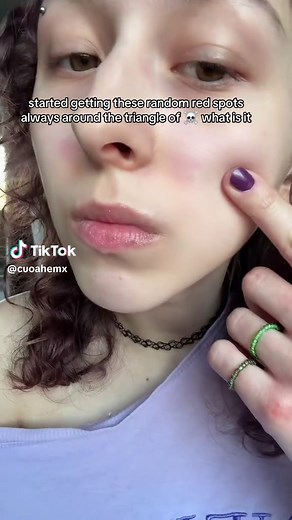 Understanding Random Red Spots on Your Skin