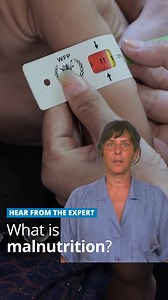 113K views · 4.8K reactions | Malnutrition isn’t just about hunger. ...