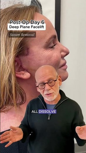 Post-Op Suture Removal Process