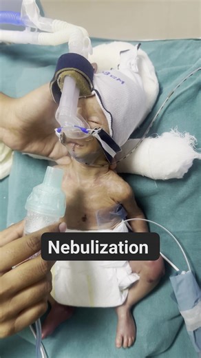 Small Steps, Strong Breaths: Nebulizing for Better Days #newborn #baby #nebulizer #nicucare #afterbirth #fblifestyle | Naveen Kumar
