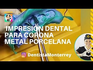 ⏭️ Impresión DENTAL 👅 CORONA METAL PORCELANA #dentaltips