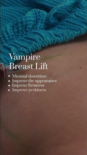 What Is A Vampire Breast Lift?