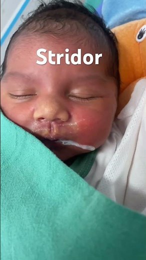 Stridor in newborn | Shorts | #neonatology #nicu #neonates