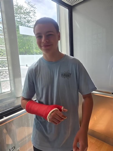 Red Arm Cast #brokenarm #brokenbone #foryou #foryoupage #viral