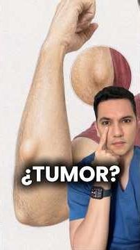 Lipoma: the most common fatty tumor. #dermatologowilliamguerrero #dermatology #healthandwellness
