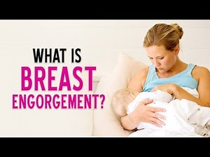 What is Breast Engorgement | Dr.Pankaj Parekh | Dr. Priti gangan | Lectsian Series | Child And You