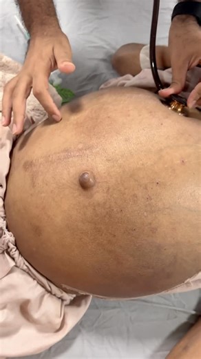 Dr M Shujat on Instagram: "Scratch Test = Simple bedside trick to find liver border. . . #doctor #drshujat #medicalstudent #medstudent #mbbs #medical"