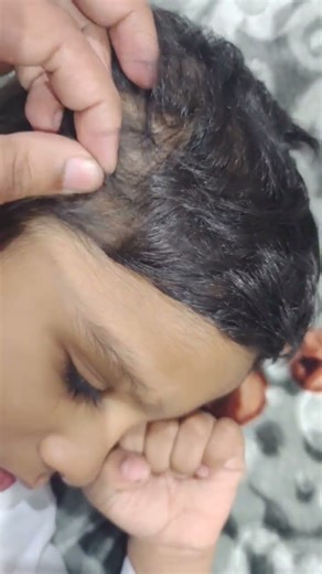 ASMR Lice Checking part,6 #asmr #piojos #lice #relaxing