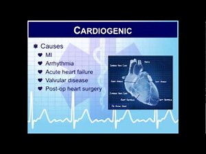 Critical Care Paramedic 14: Vasopressors and Inotropes in the Pharmacotherapy of Shock