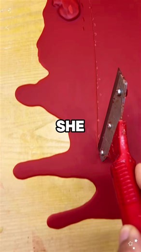 Anesthesia Fail: Unexpected Wake-Up Experience