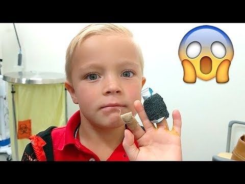 😱Kid Gets BROKEN FINGERS at School!🏫