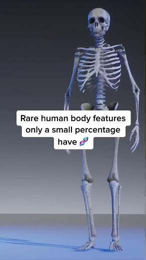 Rare Human Body Features: Unveiling Genetic Anomalies