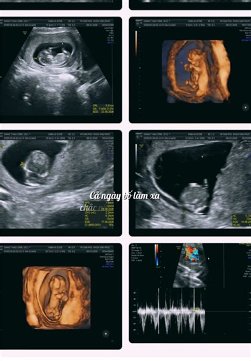 Động lực để bố mẹ cố gắng mỗi ngày, em bé ngựa tháng 9 bám mẹ thật chặt nhé, đủ ngày đủ tháng rồi ra gặp bố mẹ em nha! #lonlencungcon #embengua2026 #nguavang2026 #CapCut