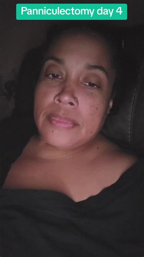 Panniculectomy Recovery Tips and Experiences