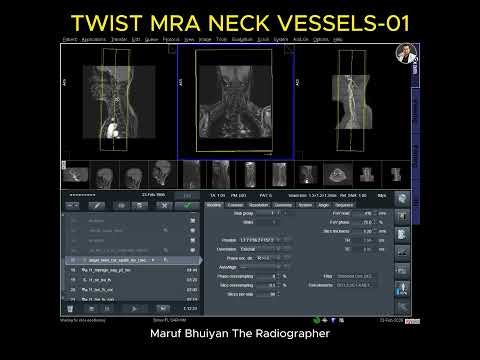 MRA Neck Vessels Post Contrast - TWIST / TRICKS / TRANCE / TIME-SLIP Technique -Part-01 | SIEMENS |