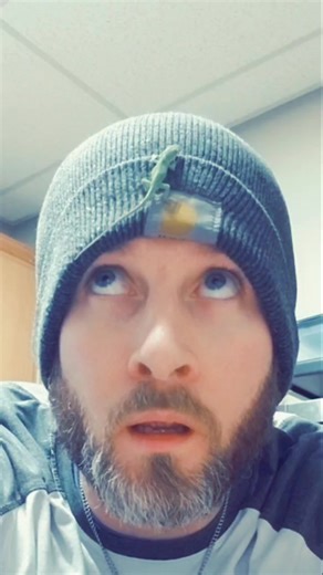 Understanding the Origins of Lizards