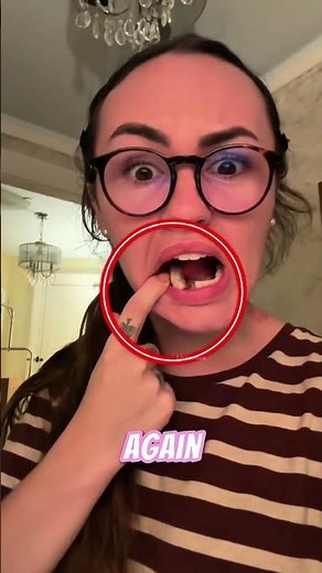 This Toothbrush Destroyed Her Smile in 1 Second! #shorts