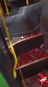 DAMN! HAND GRENADE EXPLODES IN THIEF'S POCKET