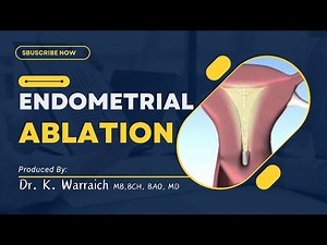 ✅ Endometrial Ablation Explained ✅By Dr K Warraich ✅ #Endometrialablation #ablation