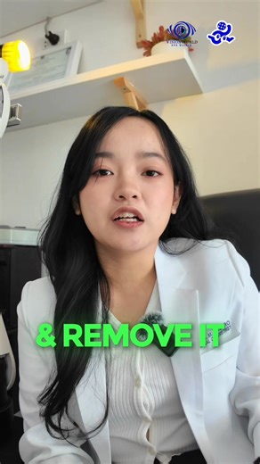 This patient came in with eye pain after using a grinder. Even with eyeglasses, a tiny piece of metal still got into his eye. Always wear proper eye protection. ⚠️ Metal shards can travel fast and penetrate the surface of the eye, causing infection, scarring, and even vision loss if not treated right away. If you feel irritation after using power tools, get checked ASAP better safe than sorry. 🥽⛑️ #visionworld #VisionWorldOptical #EyeHealth @top fans Alyssa Castro-Bernardino | Vision World Opti