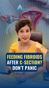 Feeding fibroids” after c-section? don’t panic — here’s what it actually means. Dr Supriya Puranik Many women, after delivery or c-section, are told they have “feeding fibroids” in their uterus. these are small, muscle-like lumps (fibroids) that grow due to increased estrogen levels during pregnancy. they may look like tiny tumors in the uterine lining and often appear in bulk numbers. Most of the time, these fibroids are harmless and manageable. but in some cases — if they cause heavy bleeding,