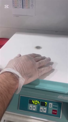 This Is How Blood Separates in a Centrifuge!🩸🎧#asmr #satisfyingvideo #PlasmaSeparation