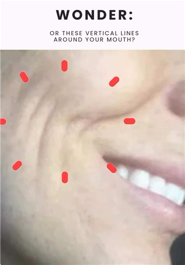 Most people don’t even know the risorius muscle exists—but overusing it can create vertical lines around your mouth and that unwanted pouch beside your lips. Learn how to find it, feel it, and stop stressing it the wrong way. Watch this before your next smile… 👉🏻 Pause & try to feel it 👉🏻 Comment “FOUND IT” if you located the muscle ____________________________________ 🛑 Stop Overworking This Hidden Smile Muscle (It’s Aging You Fast!) https://youtube.com/shorts/x2tZiYFhxnk?feature=share ___