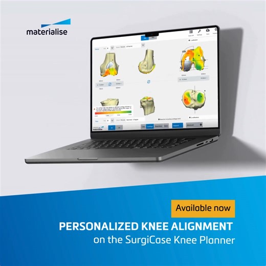 📣 Announcing the latest update to the SurgiCase® Knee Planner, now featuring Personalized Alignment® to enhance patient-specific knee arthroplasty. Try it out through our partners at Zimmer Biomet. For more information about 3D planning and guides for knee arthroplasty, click here 👉 https://mtls.am/4mJchpQ | Materialise