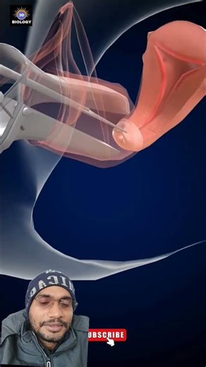 3D Concept Sprint | Devices (IUDs) | NEETIntra Uterine 2026 Biology#shorts