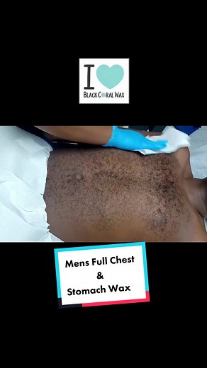 Mans Full Chest & Stomach Wax with @Black Coral Wax 🖤 Let me know in the comments what service you’d like to see me do next! #waxingqueenadventures #wax #chest #chestwaxing #estheticiantiktok #foryou #educationalpurposes #hairremoval #fyp #satisfying #beforeandafter #manwaxing #manwax #hairy #stomachwax #waxspecialist