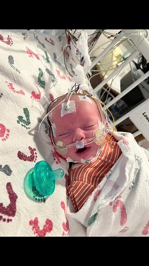 Meet Clementine… This is our story…#bonemarrowbaby #bonemarrow #bonemarrowtransplant #bonemarrowdonor #perfectmatch #bloodtransfusions #raredisease