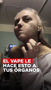55M views · 106K reactions | Usas vape presta mucha atención | Edison Matos | Facebook