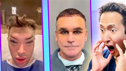 Extreme plastic surgery TikToks under the surgeon’s lens