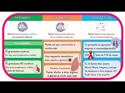 TUBERCULOSIS »PATHOPHYSIOLOGY«
