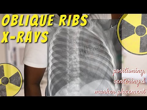 Oblique Ribs X-ray - Positioning, Centering & Marker Tips || Ask The Rad Tech