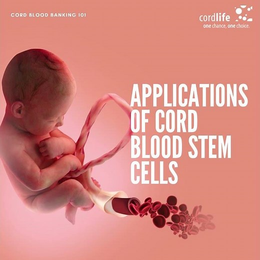 Cord Blood Banking 101 - Applications of Cord Blood Stem Cells