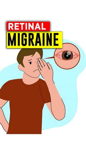 42K views · 322 reactions | What is a Retinal Migraine ? #Migraine #health #science | Doctor ASKY | Facebook