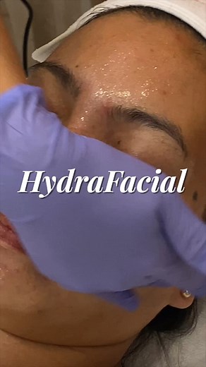 Looking for an instant hydration boost? 💧 Counter the late night Christmas Parties by treating your skin to a HydraFacial session - to revitalize, hydrate, and infuse your skin with vitamins and antioxidants which will also give your skin an added glow for the season ✨🎄 | AESTHETIC SCIENCE CLINIC