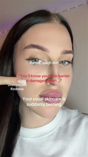 You'll know your skin barrier is damaged when you have these signs!How do you fix this?Part 2 coming