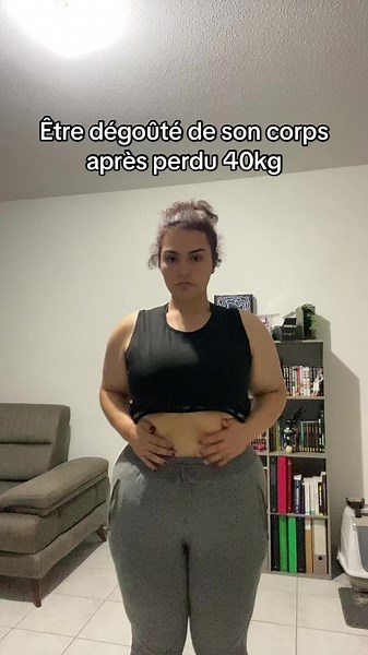 Transforming My Body: Journey After Losing 40kg