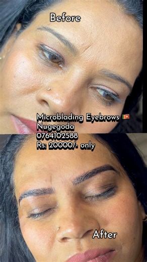 අපිලිවෙල Eye brows ස්වභාවික ලස්සනට මූනට Glow ගතිය තවත් වැඩි වෙන විදියට හදමුද??? ✨ Microblading සහ Microshading එකක් රුපියල් 20000/- ක් වගේ මුදලකට අපෙන් 🫣 වසර දෙකක වගකීම අපෙන් 🌸 📍 At Glamour Nails Beauty Studio, Nugegoda 👩‍🦰 Ladies Only 💫 Book your appointment now & wake up with flawless brows! 📞 Contact: 0764102588 Microblading Eyebrows 👁️✨ SPECIAL OFFER 💕 ✨ Perfect Brows, Every Day ✨. No more daily eyebrow struggles – let us give you the brows of your dreams! 💖 🌸 Microblading Eyebrow